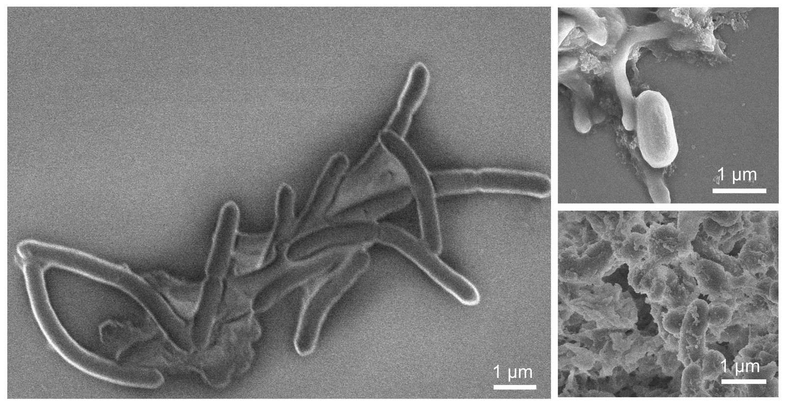 Survival of a Bacillus species from a microbial community exposed to painted drywall; vegetative state (left), sporulation state (top right), in antimicrobial swab (bottom right) // Credit: Hartmann Lab