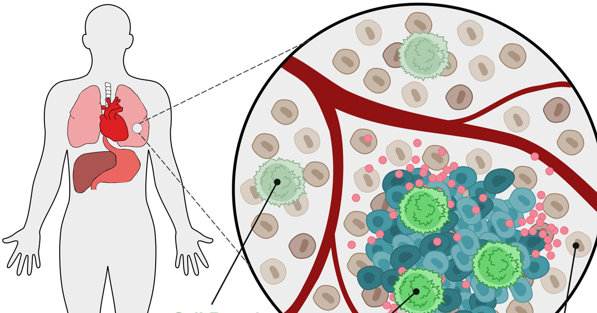 Northwestern Receives First NIH Research Project Grant Dedicated to ...