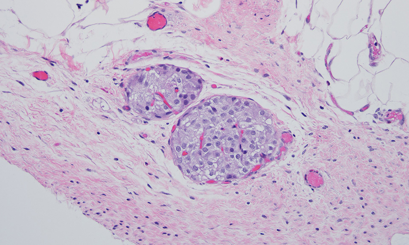 This image shows transplanted islets (darker purple) and the blood vessels (the red/dark pink areas are blood cells inside the blood vessels).