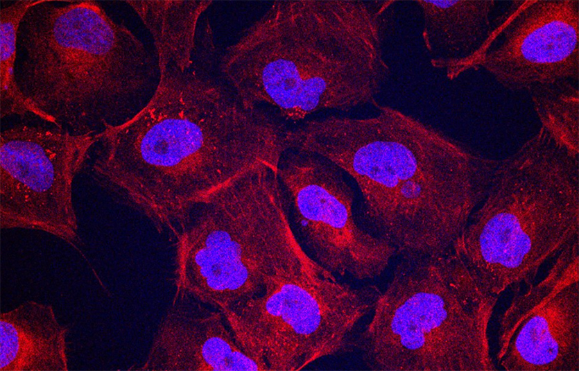 In new experiments, human cartilage cells treated with fast-moving dancing molecules made more collagen II (shown in red), a crucial component for regeneration. Cell nuclei are shown in blue/purple.
