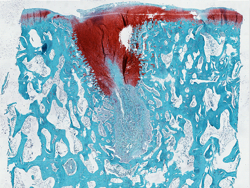 The treated cartilage (stained with safranin) shows the defect filled in.